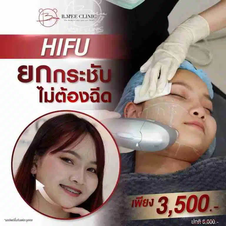 โปรโมชั่น HIFU ยกกระชับไม่ต้องฉีด บ้านหมี คลินิก
