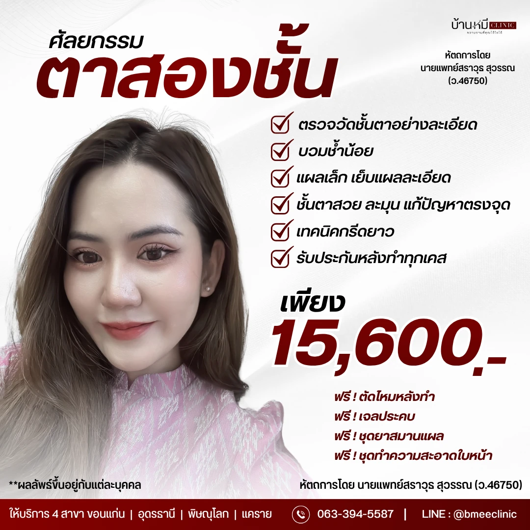 โปรโมชั่นศัลยกรรมตาสองชั้น ราคาพิเศษ 15,600 บาท บ้านหมี คลินิก