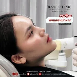 รีวิวฟิลเลอร์หน้าผาก บ้านหมี คลินิก