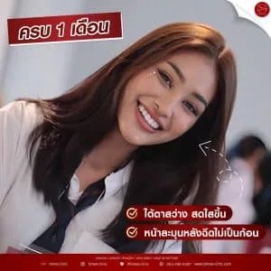รีวิวฟิลเลอร์ใต้ตา บ้านหมี คลินิก
