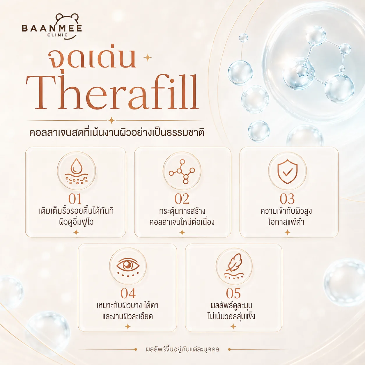 จุดเด่น Therafill Program เติมเต็มริ้วรอยตื้นได้ทันที กระตุ้นการสร้างคอลลาเจนใหม่ต่อเนื่อง ความเข้ากับผิวสูง โอกาสแพ้ต่ำ เหมาะกับผิวบางและใต้ตา