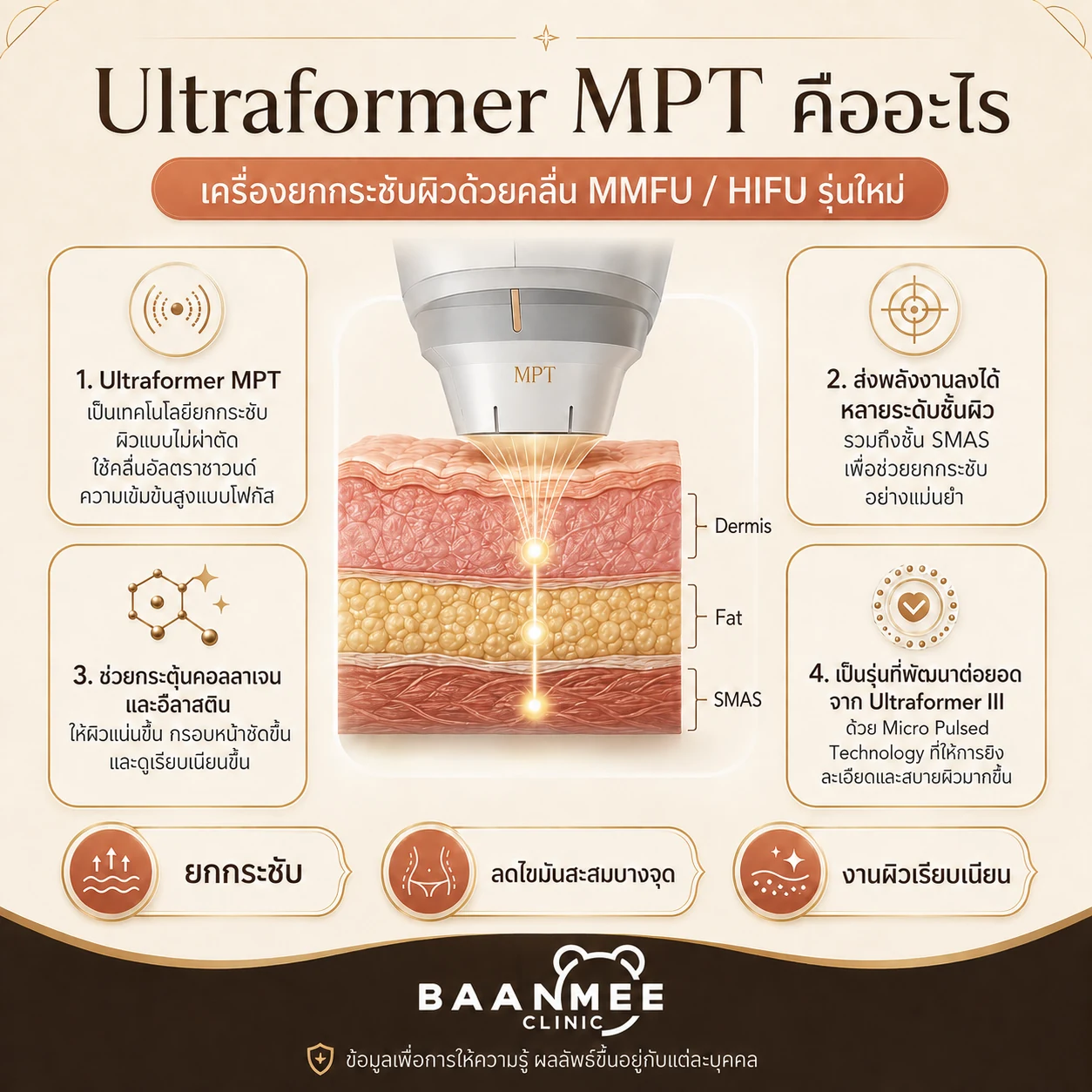 Ultraformer MPT คืออะไร เทคโนโลยียกกระชับ MMFU ลงลึกถึงชั้น SMAS บ้านหมีคลินิก