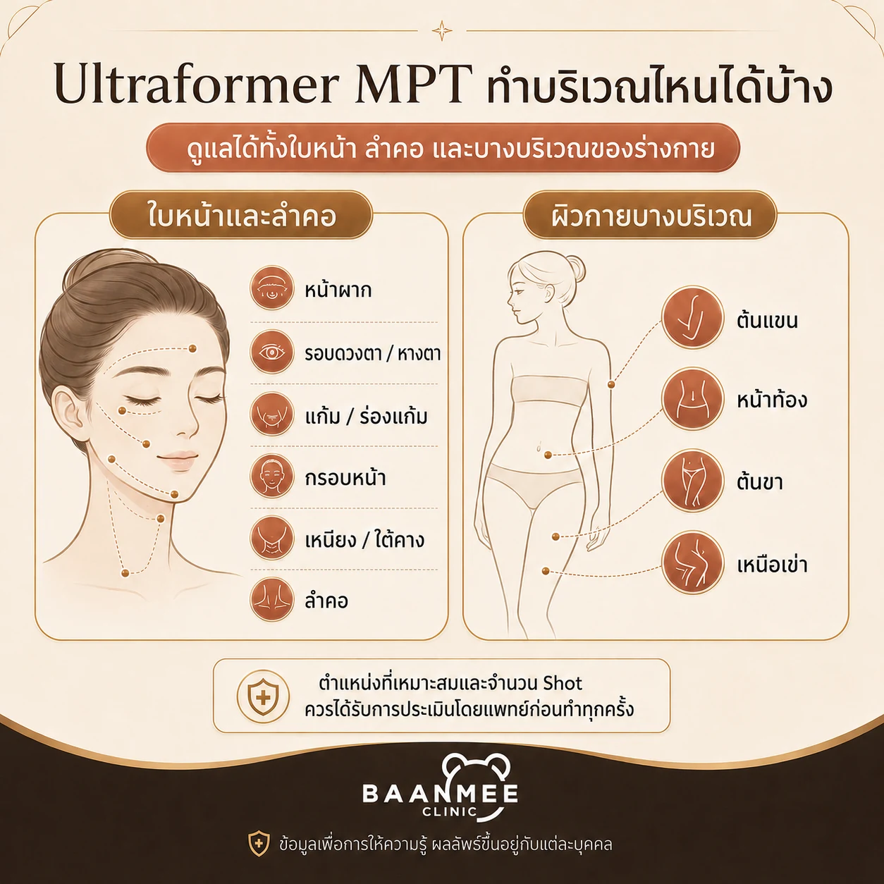 บริเวณที่ทำ Ultraformer MPT ได้ ใบหน้า ลำคอ ต้นแขน หน้าท้อง ต้นขา