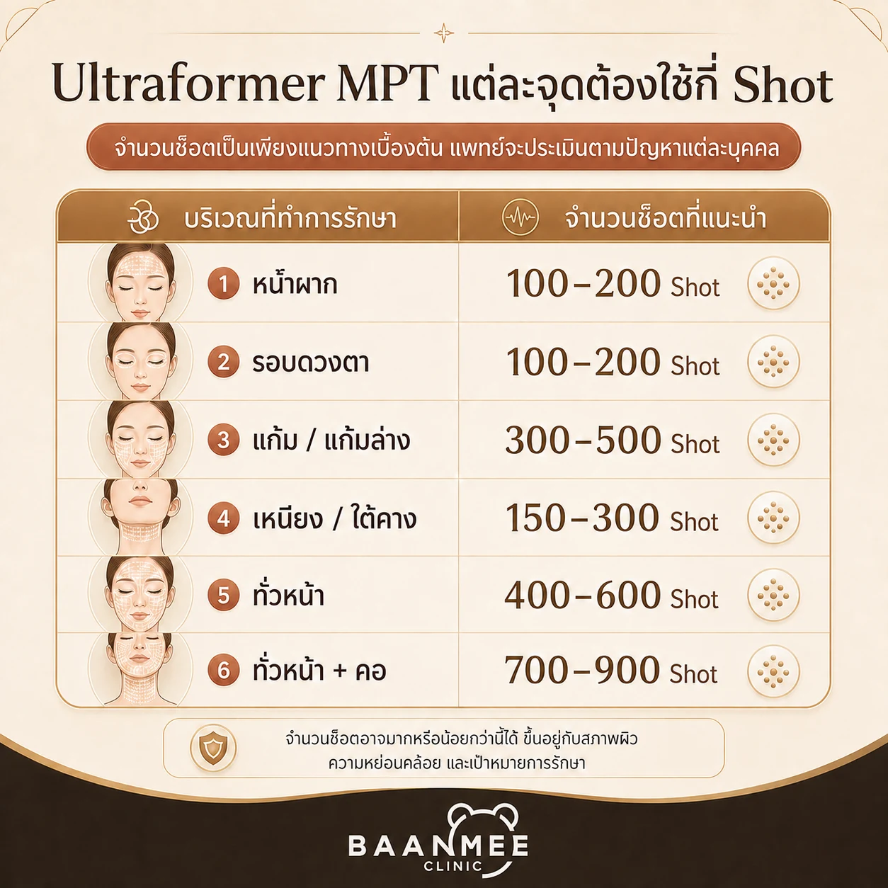 จำนวนช็อต Ultraformer MPT แต่ละบริเวณ
